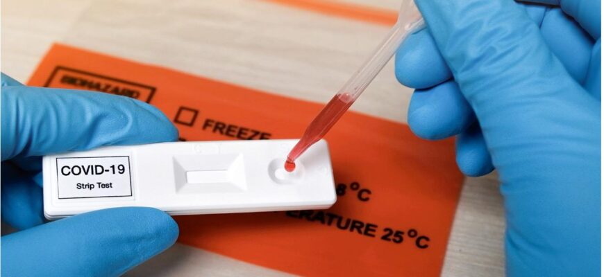 Документи та медичні довідки для подорожей: коли потрібен ПЛР-контроль для виїзду за кордон