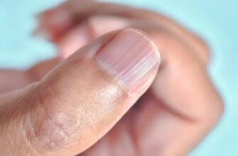 Що робити, коли слояться чи ламаються нігті на руках